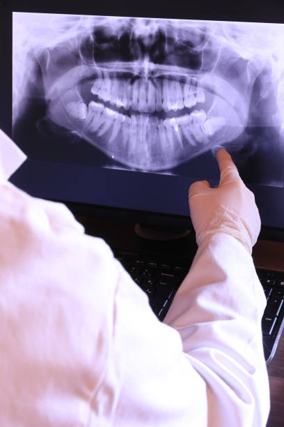 Best Emergency Root Canal Treatment in Whitewater, WI